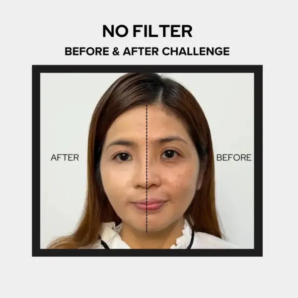 Before After 1 1.webp