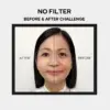 Before After 2 1.webp