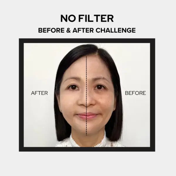 Before After 2 1.webp