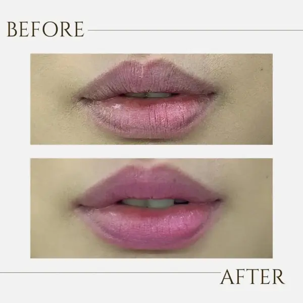 Before After.webp